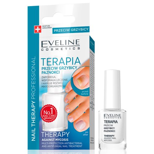 EVELINE THERAPY SUPPORTING THE TREATMENT MYCOSIS